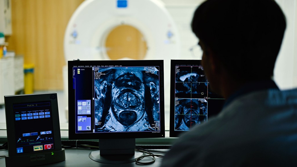 Foto: Ein Mediziner betrachtet das Querschnittsbild einer Prostata