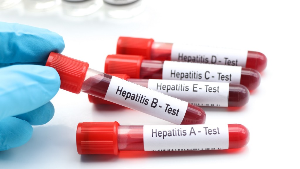 Eine Person hält einen Hepatitis B Test in der Hand. Daneben weitere Teströhrchen.