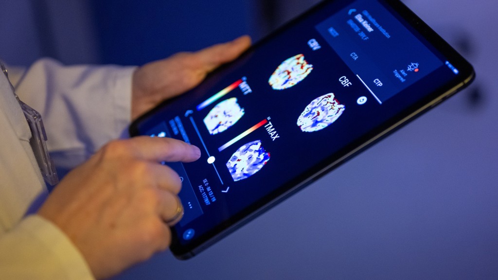 Eine Radiologin betrachtet in einer KI-basierten App auf einem Tablet Gehirnbilder eines Patienten. 