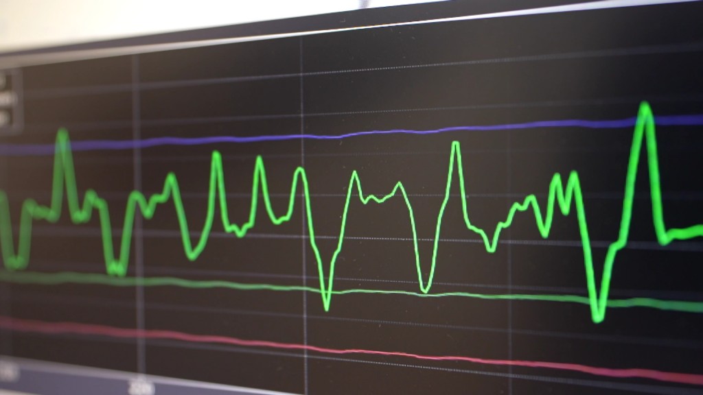 Foto: Monitor zur Neuroforschung