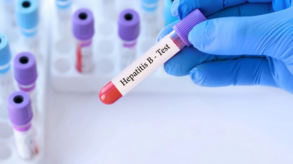 Foto: Eine Person hält im Labor einen Hepatitis B Test in der Hand