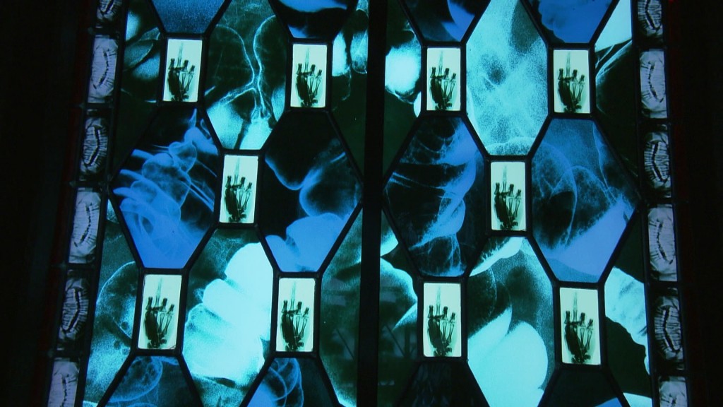 Foto: Röntgen-Aufnahme