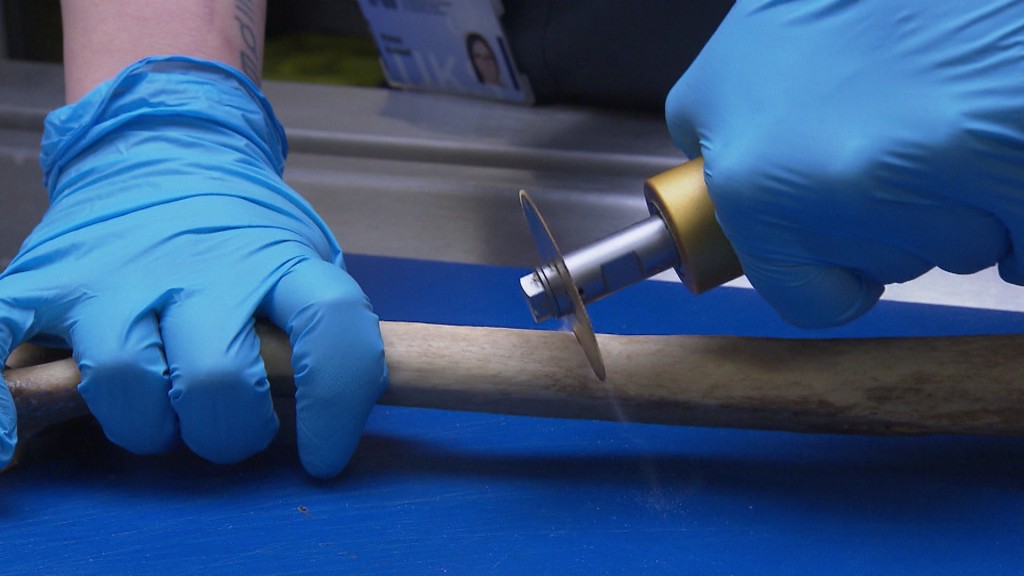 Foto: Eine Gerichtsmedizinerin bei der Arbeit 