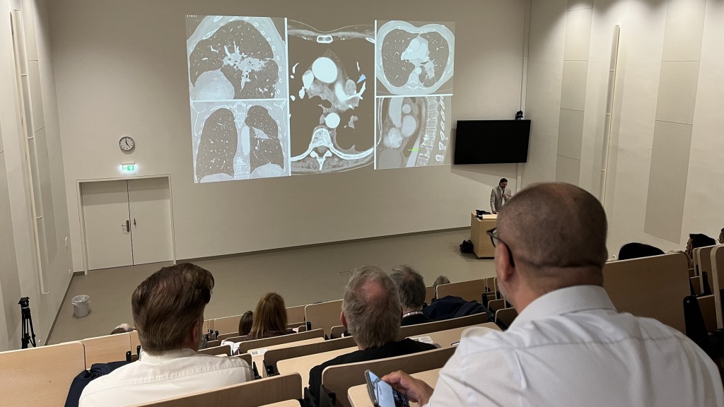 Foto: Informationsveranstaltung Lungenkrebsscreening